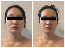 ブレスビューティー(BLESS BEAUTY)の雰囲気（ただのコルギではない！効果を即座に実感！上半身を華奢みえに）