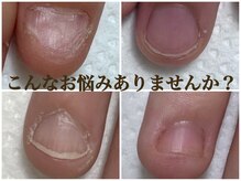アメジスト(Amethyst)の雰囲気（深爪改善で理想の指先を目指します♪お悩みご相談ください）