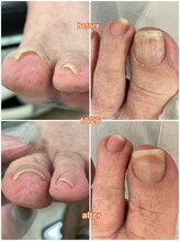 ヴィアンジュ 浦和コルソ店(Vie Ange)/BSフットケア