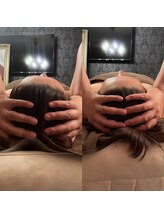 森の時計/症例写真:頭蓋矯正編