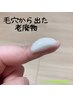 【シミ改善・細胞デトックススペシャル★】当店看板メニュー！100分 ¥16500