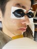 【メンズ脱毛】ひげ10回券★先着5名様　定価70000円→33000円