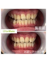 ルブラン 奈良店(Le Blanc)/お試しクーポンからフリーパスに