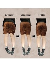 ヴィセル(VISEL)/