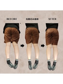 ヴィセル(VISEL)/