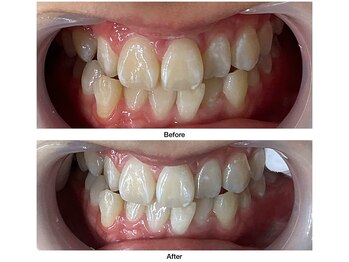 コアルナ センター北店(Coalna)/歯科提携・セルフホワイトニング