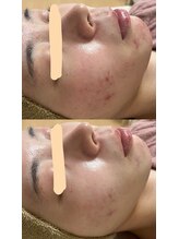 サロンモア(salon More)/