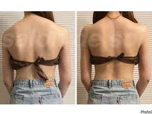 サロン ド ソワ(salon de soi)/肩の盛り上がり