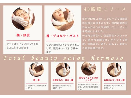 エルモソ(Hermoso)の写真