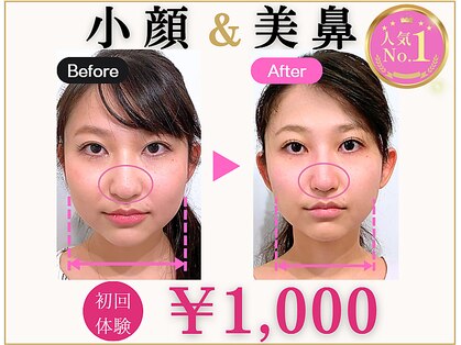 ラプリ 梅田店(Raplit)の写真