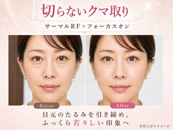 オリエンタルローザ 表参道(Oriental Rosa)/切らないクマ取りで目元の影解消