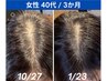 再髪ヘッドスパコース+P1幹細胞培養上清頭皮美容液1本 ¥27500→¥24200