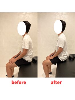 ナオル整体 福岡香椎院(NAORU整体)/30代弾勢施術事例【猫背】