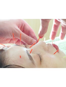 小顔になりたい