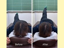 ナオル整体 大宮院(NAORU整体)/股関節の可動域UP