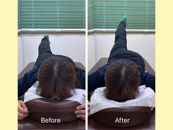 ナオル整体 大宮院(NAORU整体)/股関節の可動域UP