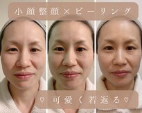 ソワン(soin)