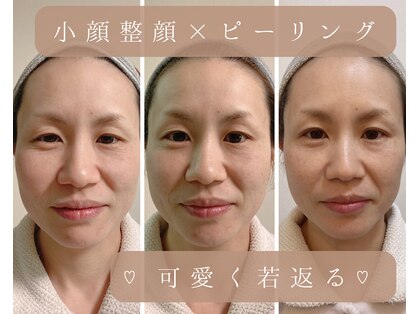 ソワン(soin)の写真