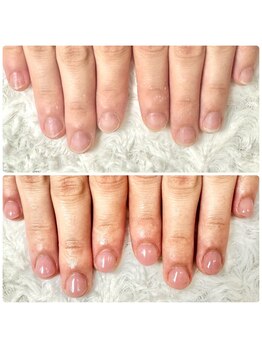 グレースレディ 大阪店/2時間で悩みが解消