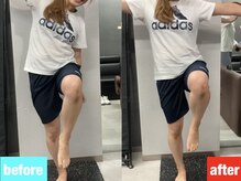 スフィーダ(SFIDA)/片足立ちビフォーアフター