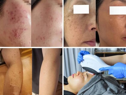 ハーブスキン(herb skin)の写真
