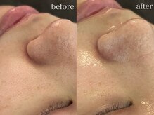 テオリア(TEORIA)/