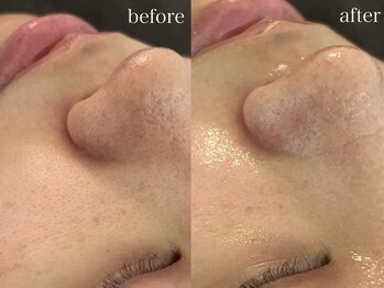 テオリア(TEORIA)/