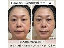 ハンナリ(Hannari)の雰囲気(プロのアプローチで改善ステップを踏みながら、効果実感!)