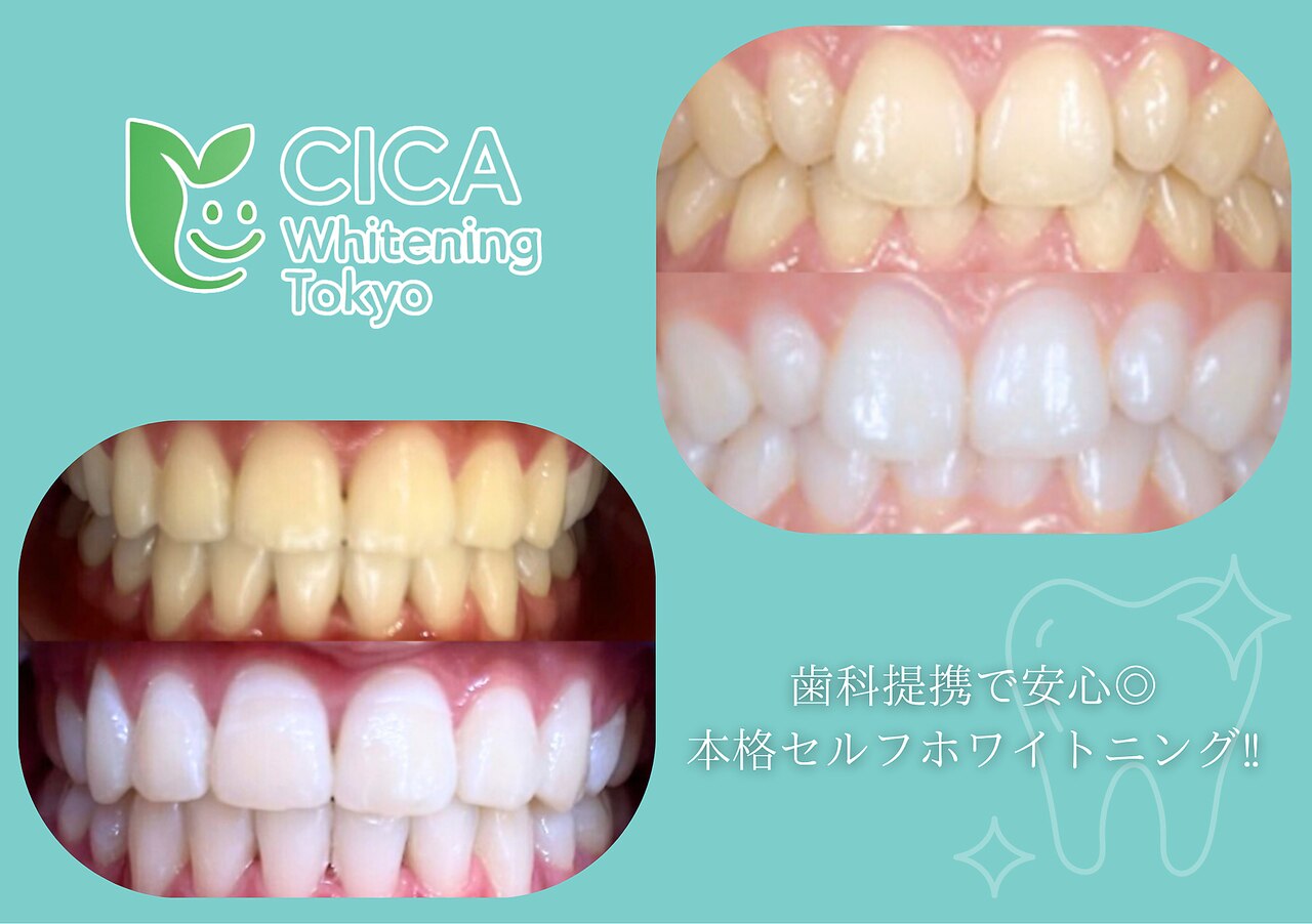 シカホワイトニングトウキョウ 笹塚店(CICA Whitening Tokyo