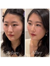 シャルム(Sharme)/お客様Before→After