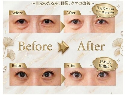 エヴァーグレース プレミシャス 心斎橋店(EVER GARACE Premycious)の写真