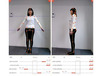 カラダファクトリー 溝の口ノクティプラザ店/AIによる姿勢チェックを実施
