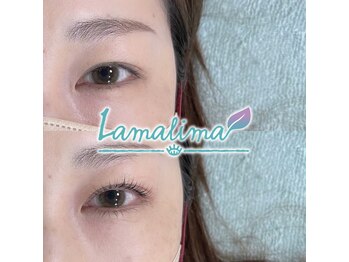 ラマリマ(Lamalima)/Lash Lift