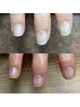 リリ(lili)/トータルハンドケア1回目