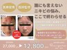 【当店おすすめ】繰り返すニキビ＆肌跡ケア◎医療提携×細胞アプローチ12,800