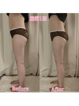 ヨサパーク サーナ 仙川(YOSA PARK Sana)/30代お客様ビフォー⇒アフター