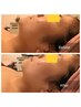 【超リフトコンビ！先着５名様】小顔コルギ+白玉リフティング1000shot9900円