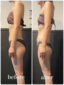 ピーラトゥ 日立(P-Ratu)/ブライダルコース