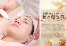 グラチア(Gratiae)