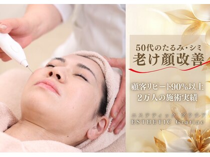 グラチア(Gratiae)の写真