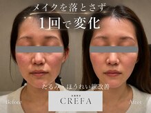 クレファ(CREFA)