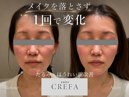 クレファ(CREFA)の写真
