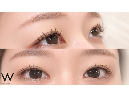 ダブリューアイビューティー 浦和店(W EYE BEAUTY)の写真