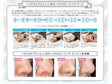 エステSi belleの雰囲気(ハイドロ毛穴)