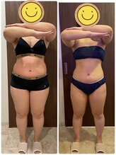 あきくに整骨院 美容整体院/30代女性