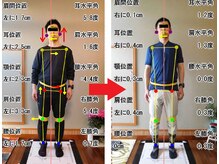 チャラク(charaku)/【40代N様：全身矯正|背骨湾曲】