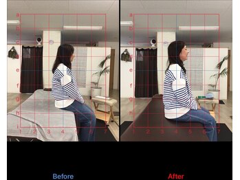 ストレチックス 近江八幡店/BeforeAfter