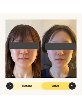 リノリー 古川店(rinory)/人気No. 1〈小顔矯正〉