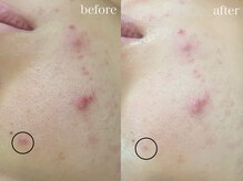 テオリア(TEORIA)/