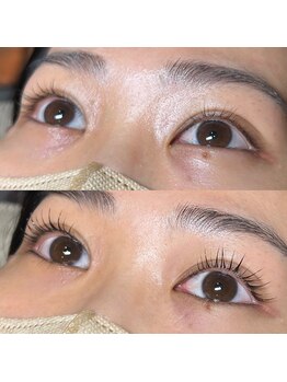 ソア 並木坂店(Soa)/まつ毛beforeafter*